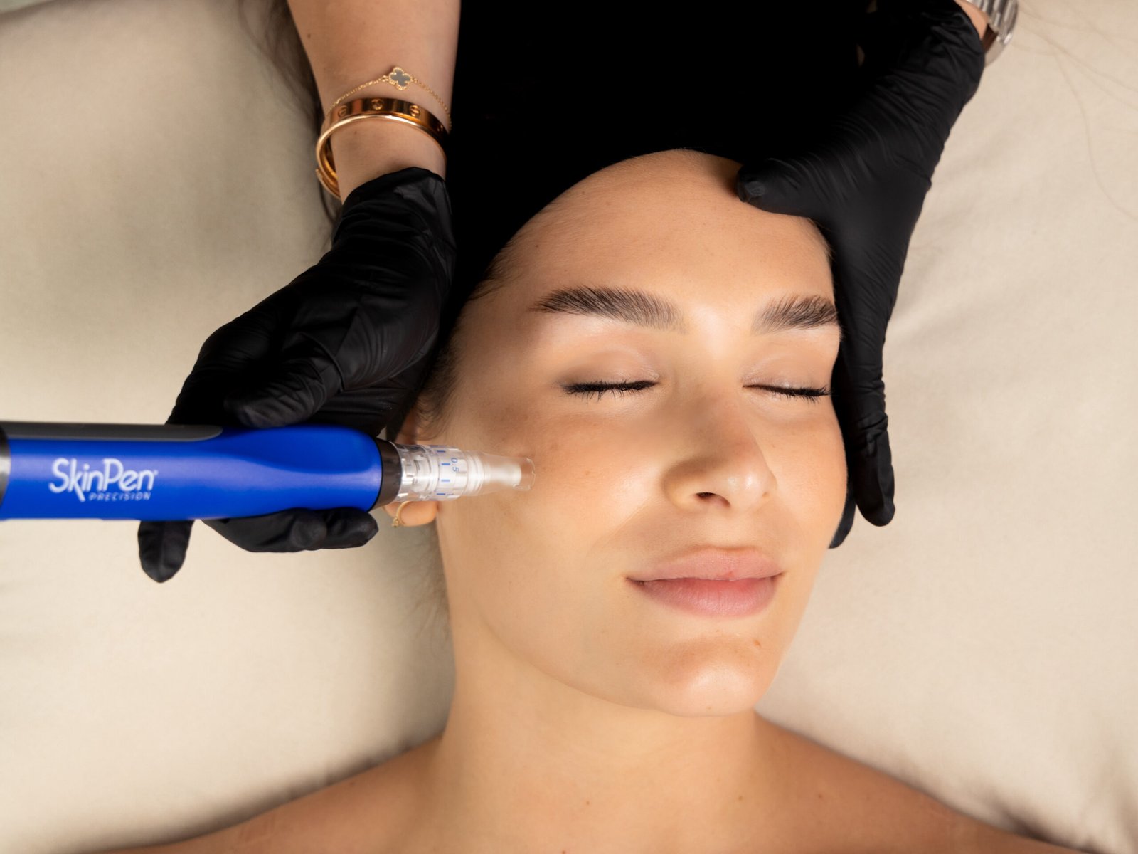 SkinPen: The Expert Care Guide Pre/Post Care & Candidates