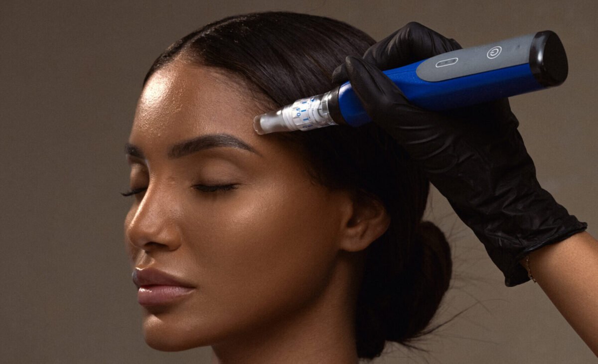 SkinPen in Puerto Vallarta: The Celebrity-Favorite Microneedling Treatment for Flawless Skin